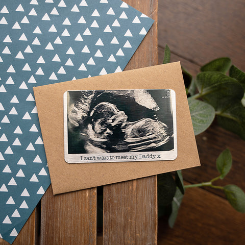 Aluminium Baby Scan Photo Wallet Card